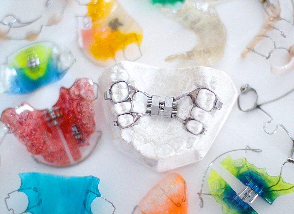 Orthodontic Appliances in North York