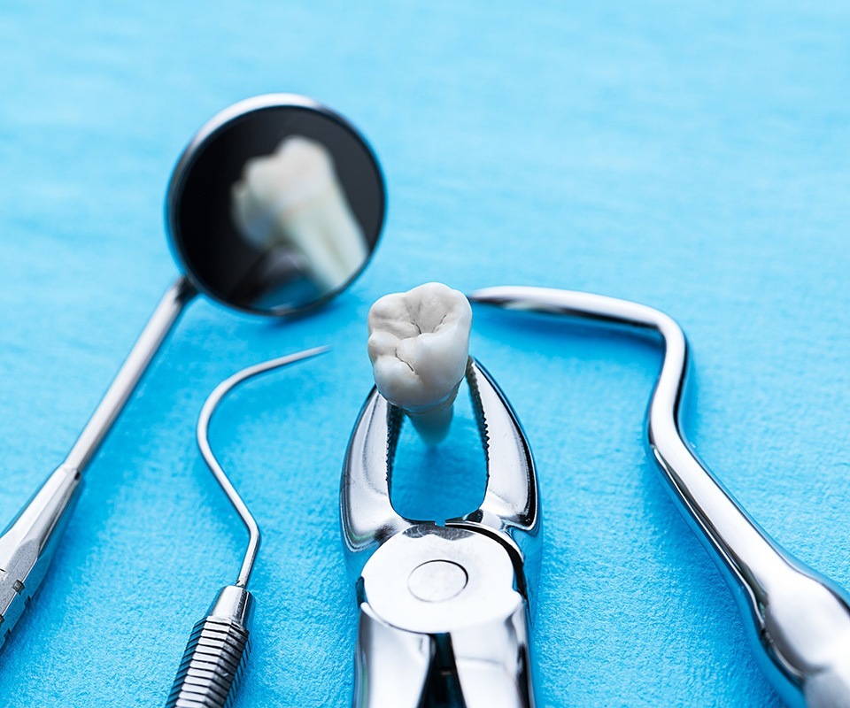 Tooth Extraction North York