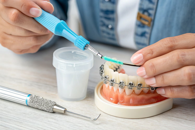 a picture showing the way to brush your teeth with braces 