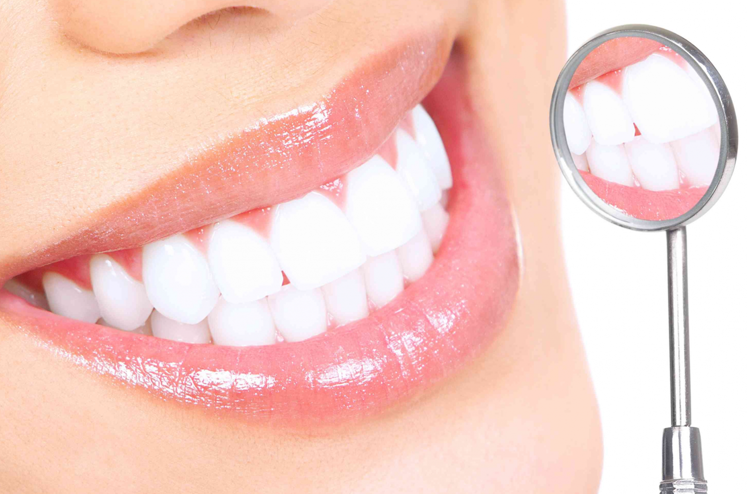 Teeth Whitening