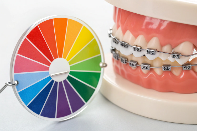 a photo showing the best colors for braces on a braces color wheel 