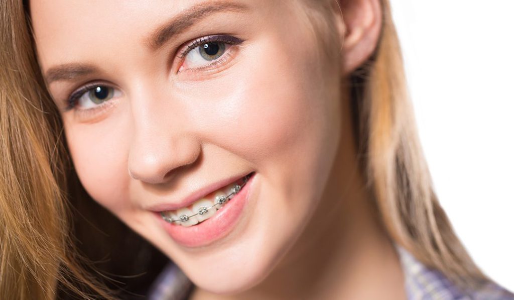 an adult wearing braces