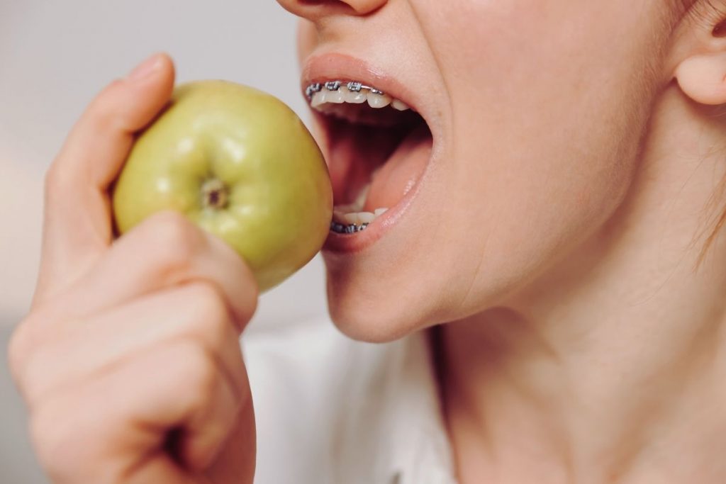 common mistakes when wearing braces: eating hard food