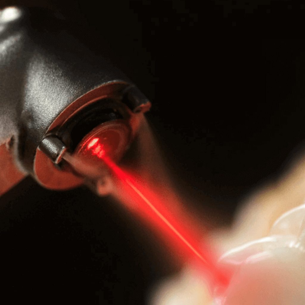 Laser dentistry