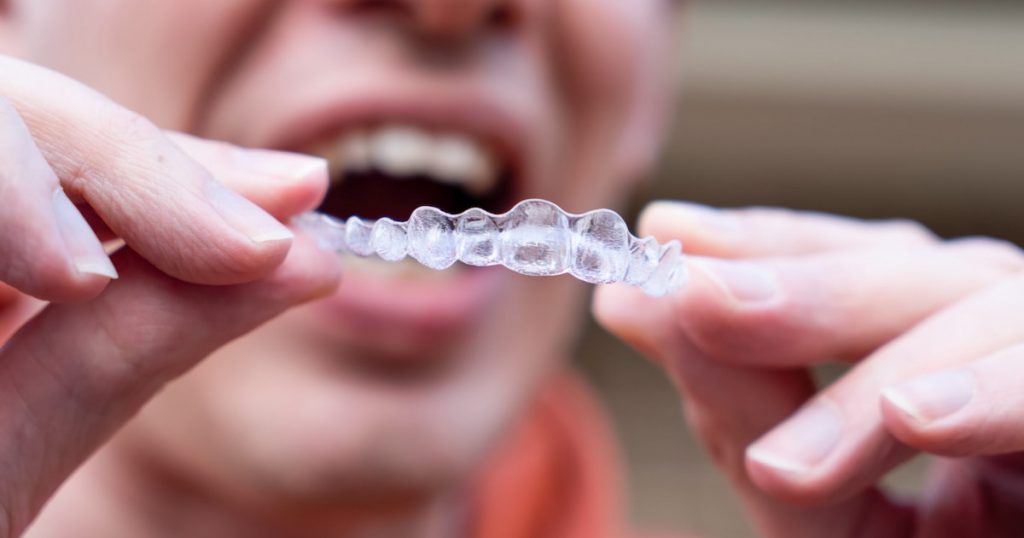 a person holding Invisalign in front of his face