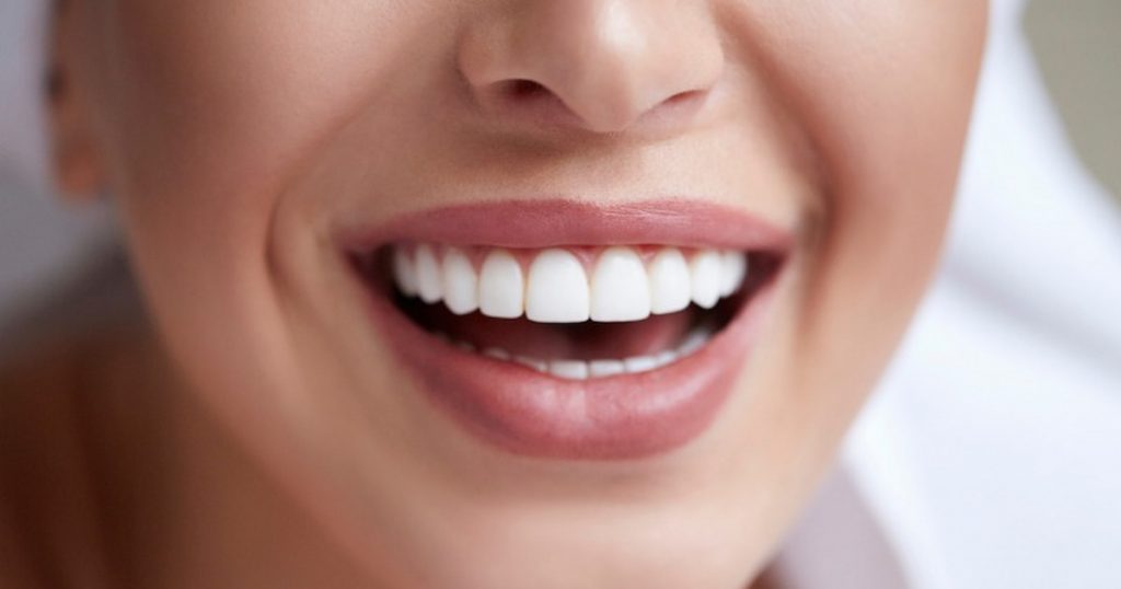 a photo showing what your teeth will look like after orthodontic treatment