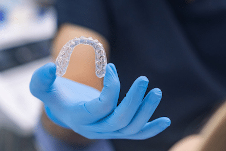 a photo of a dentist holding an Invisalign tray