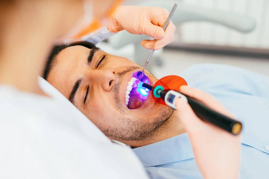 dental sealants