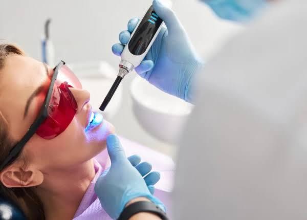 sealants