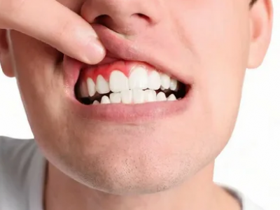 Gum Disease Treatment Gum Disease Treatment