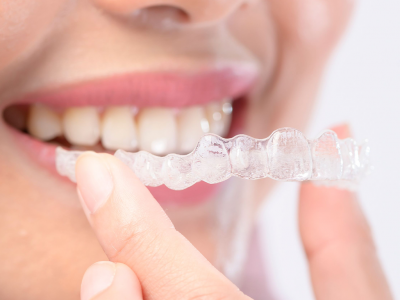 Invisalign and Clear Aligners